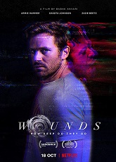 Wounds ● Vj Junior